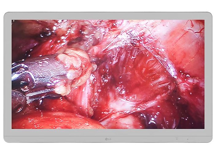 LG 27HJ710S-W 27" 4K UHD Surgical Monitor