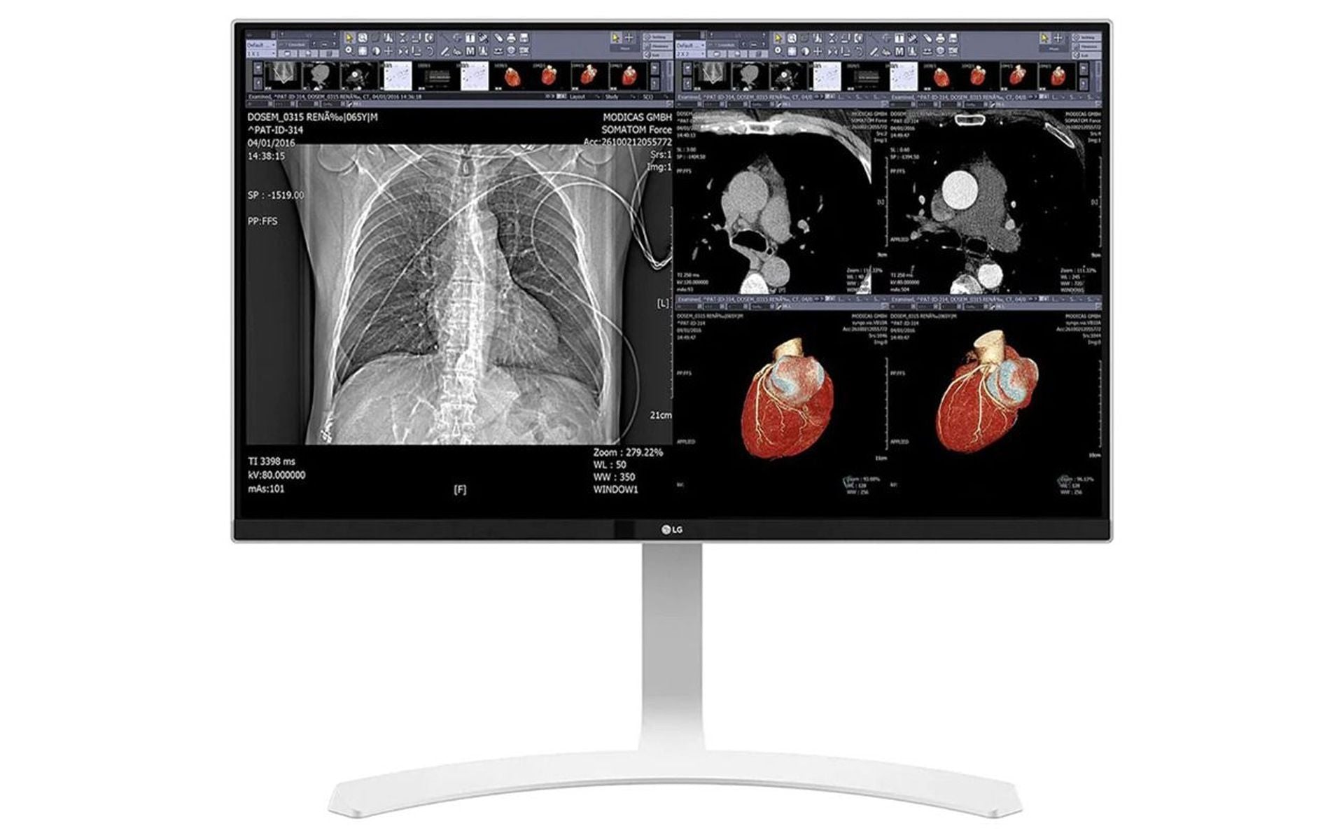 LG 27HJ712C-W 8MP Clinical Review Display Monitor
