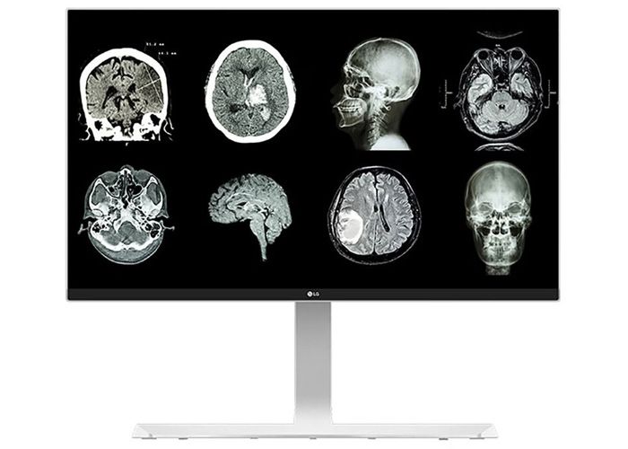 LG 27HJ712C-W 8MP Clinical Review Display Monitor