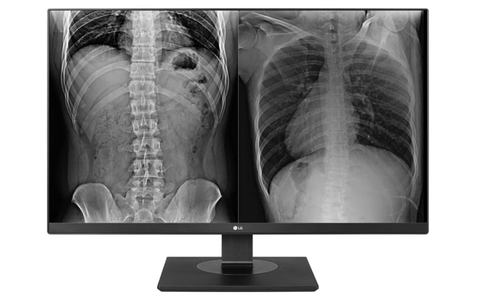 LG 27HJ713C-B 8MP Clinical Review Display Monitor