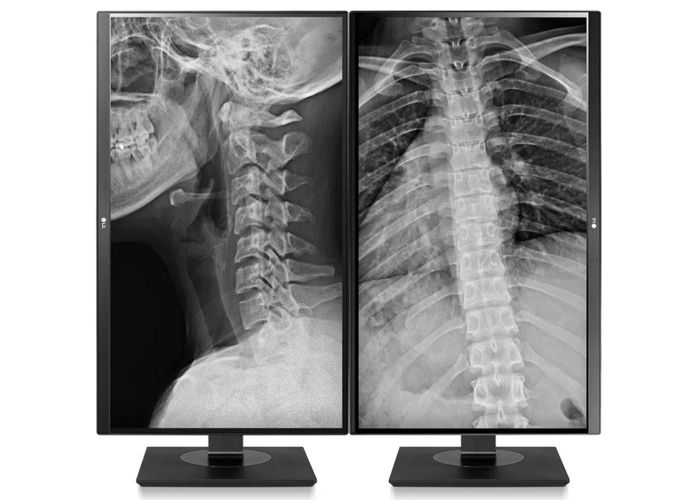 LG 27HJ713C-B 8MP Clinical Review Display Monitor