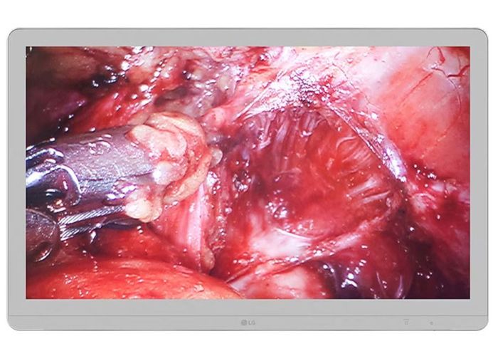 LG 27HJ713S-W 27" 4K UHD Surgical Monitor
