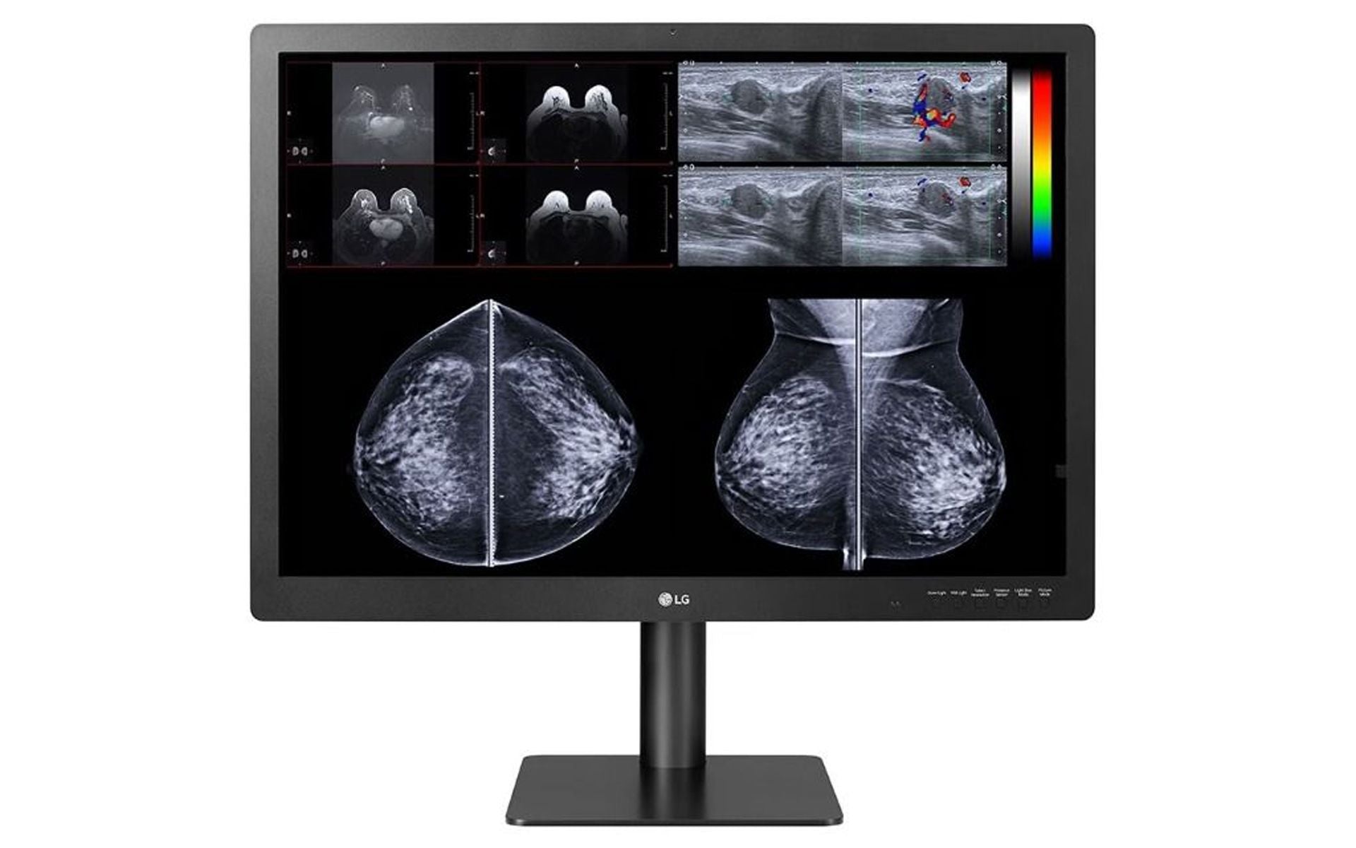 LG 31HN713D-B 31" 12MP IPS Diagnostic Medical Monitor