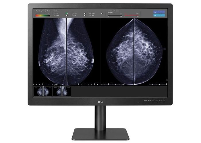 LG 31HN713D-B 31" 12MP IPS Diagnostic Medical Monitor