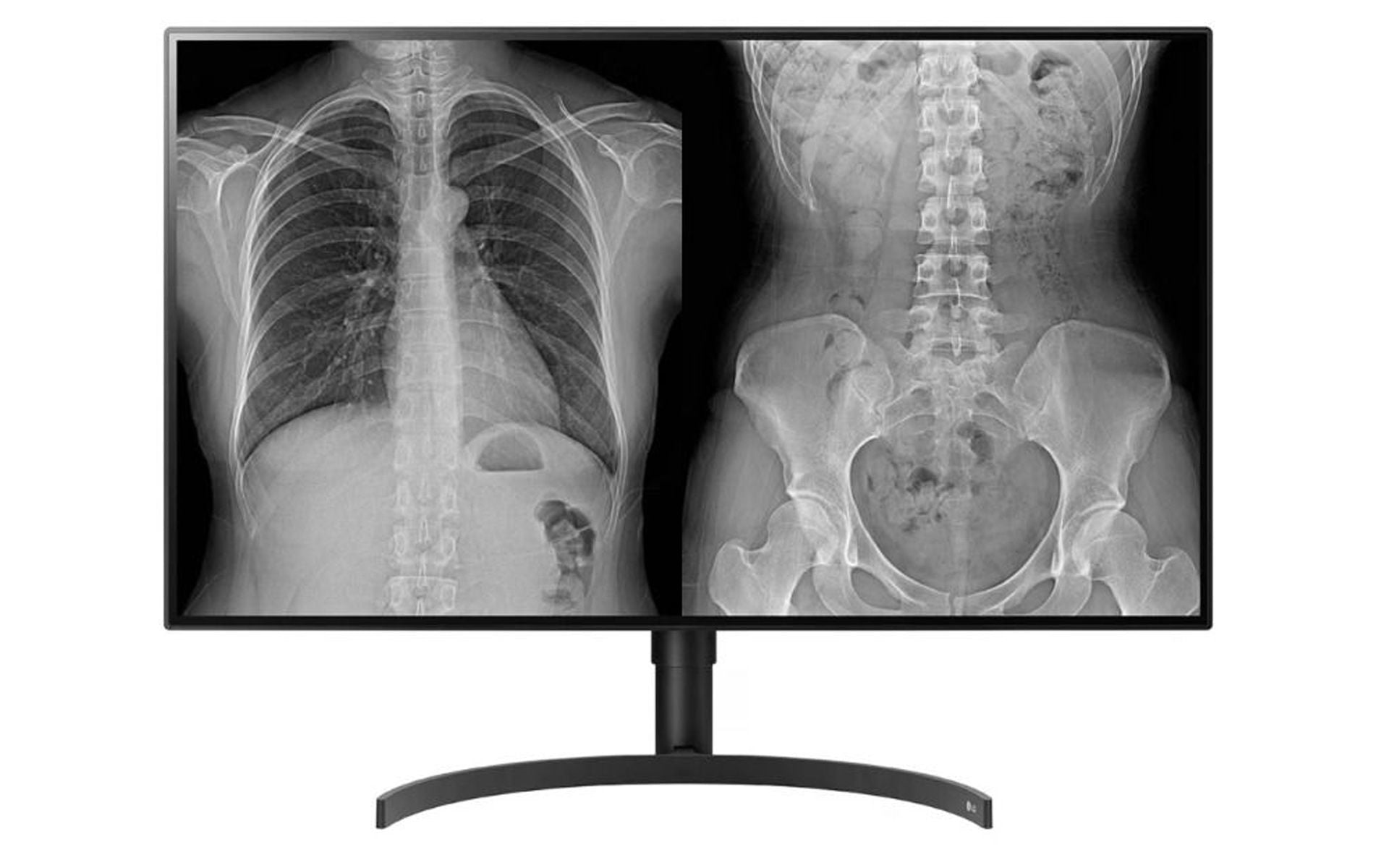 LG 32HL512D-B 8MP Diagnostic Radiology Monitor