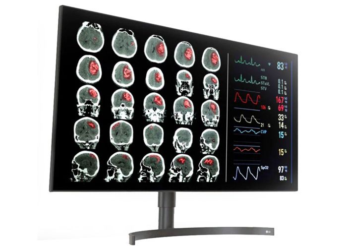 LG 32HL512D-B 8MP Diagnostic Radiology Monitor