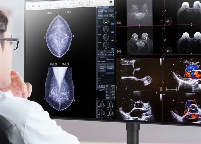 LG 32HL512D-B 8MP Diagnostic Radiology Monitor