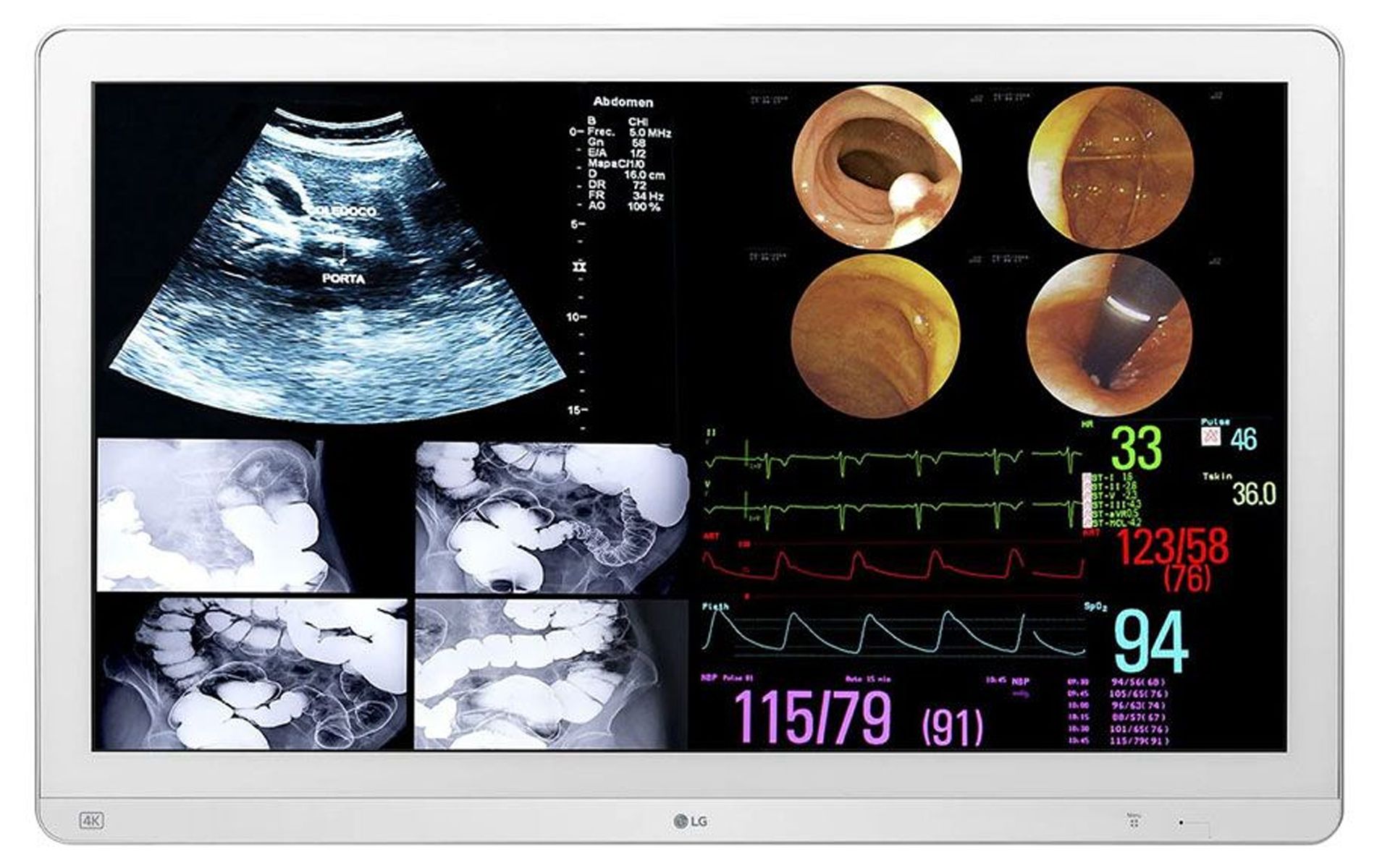 LG 32HL714S-W 31.5" 4K UHD Surgical Monitor