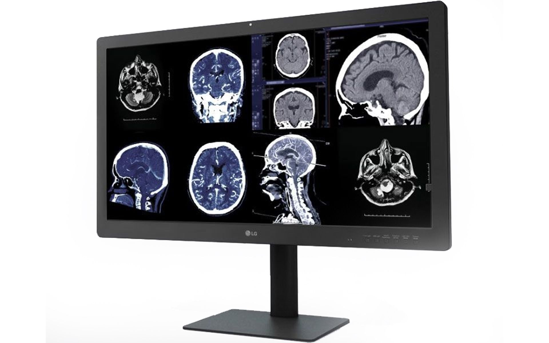 LG モニター　32インチ LG 32HQ713D-B 8MP Diagnostic Radiology Monitor – Ampronix