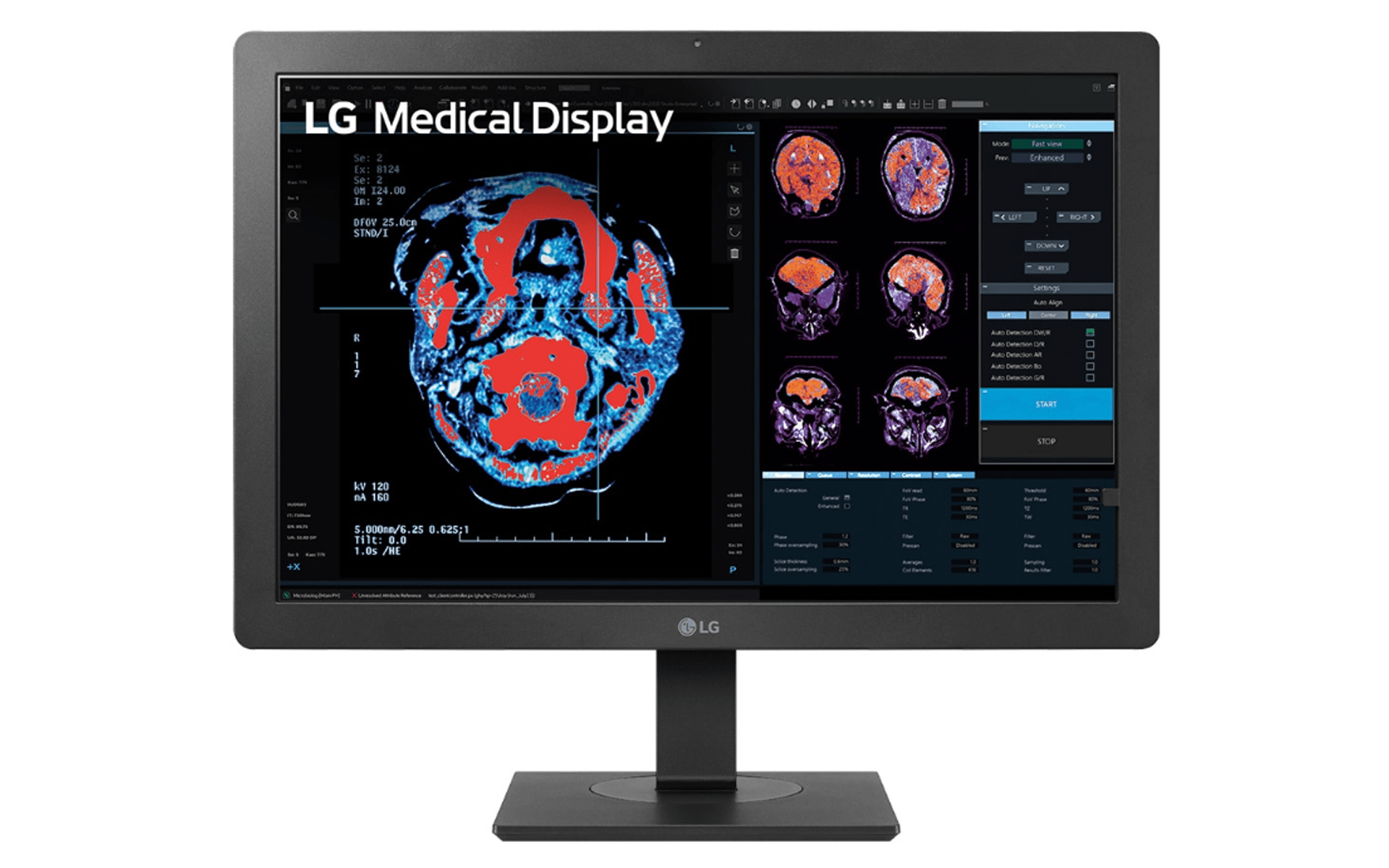 LG 24HR513C-B 24" 2MP IPS Clinical Review Display Monitor