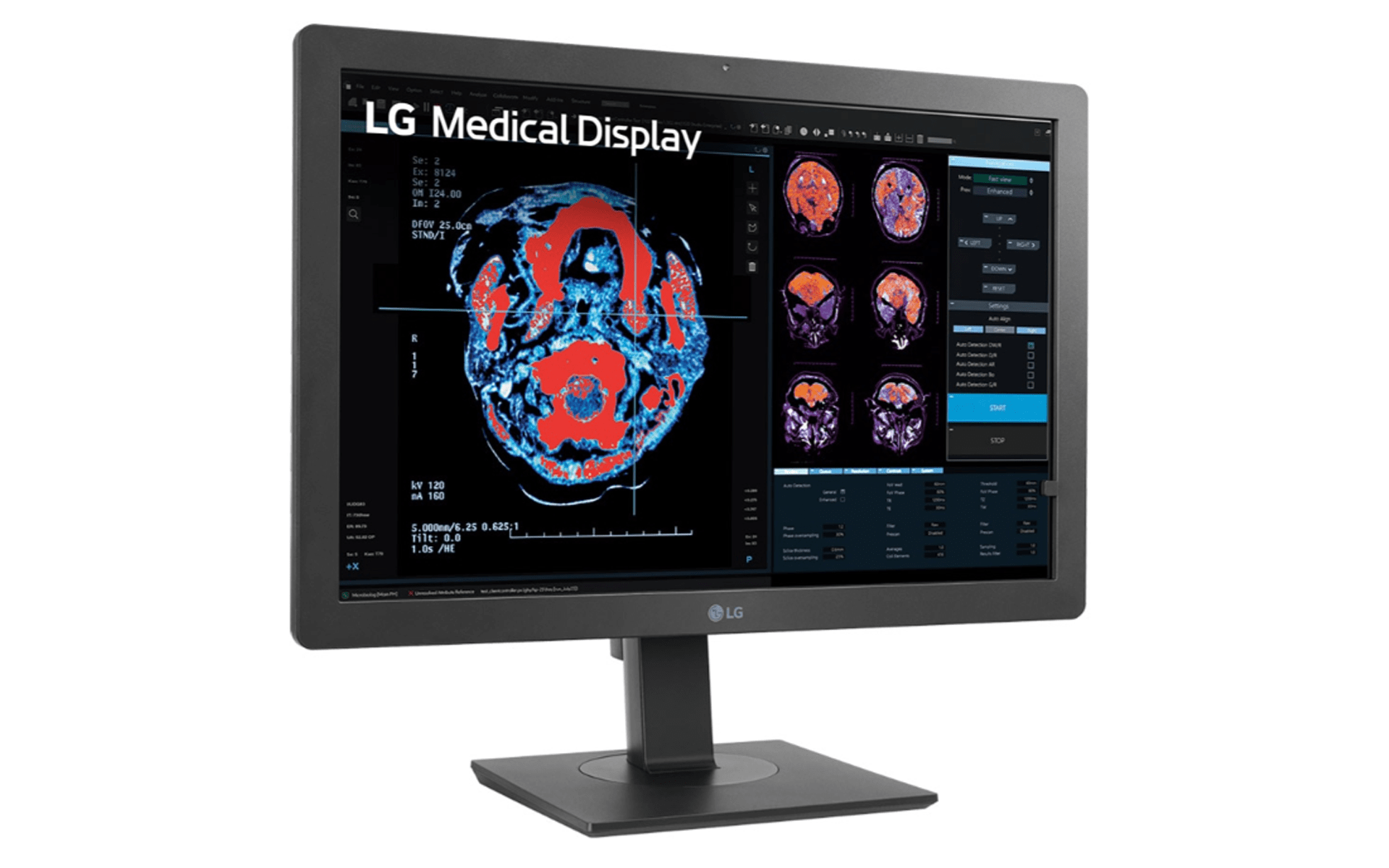 LG 24HR513C-B 24" 2MP IPS Clinical Review Display Monitor