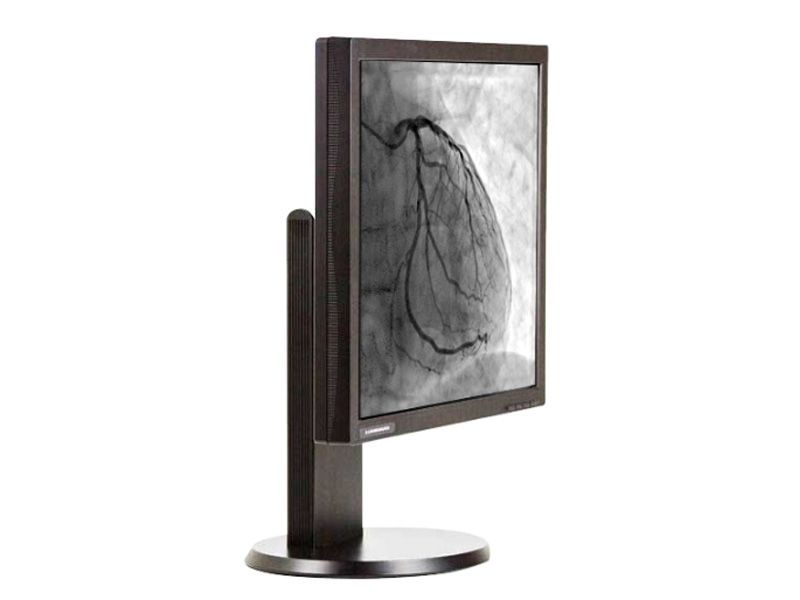 Lumimaxx G11S 1MP Clinical Review Display Monitor