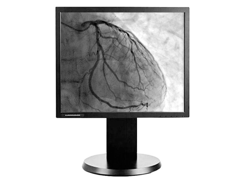 Lumimaxx G11S 1MP Clinical Review Display Monitor