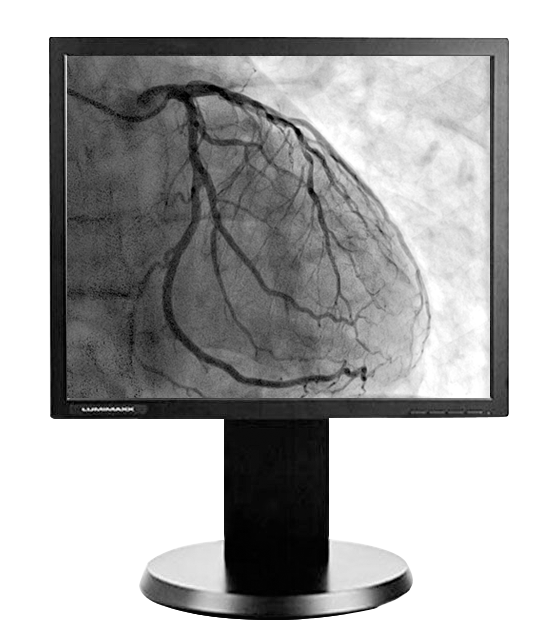 Lumimaxx G11S-DC 1MP 19" Medical Grade Grayscale LCD Monitor
