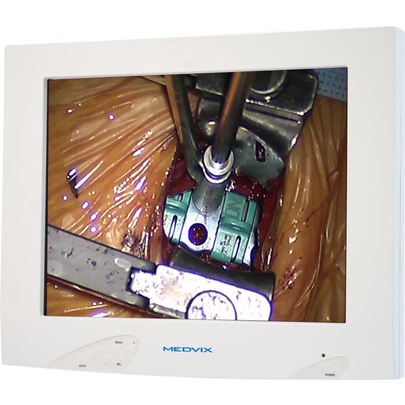 Medvix AMVX1508 15" XGA Surgical LCD Monitor