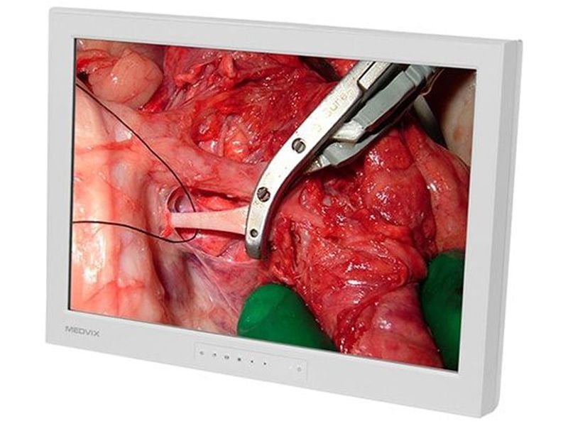 Medvix AMVX2408HD 24" WUXGA Surgical Monitor