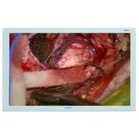 Medvix AMVXL3708 37" FHD Surgical LCD Monitor
