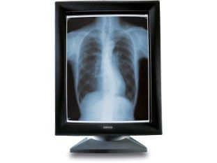 Barco MGD-521 5MP CRT Monitor Display
