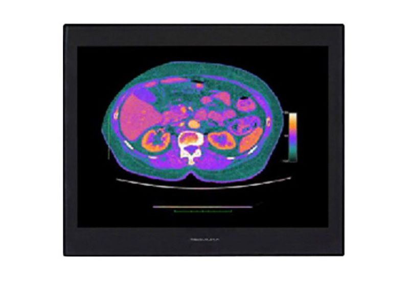 Modalixx GC212HB 21.3" UXGA Color 2MP Multi-Modality Monitor