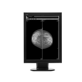 WIDE MX50s 5MP Diagnostic Radiology Monitor