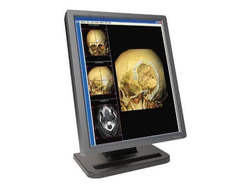 NDSsi DOME E3CHB 3MP Diagnostic Radiology Monitor