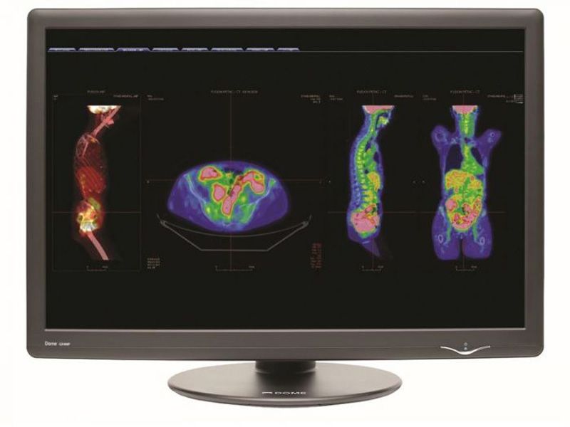 NDSsi DOME GX4MP 4MP Diagnostic Radiology Monitor