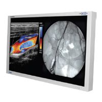 NDSsi Radiance 55" G2 FHD LED Surgical Monitor - 90R0068