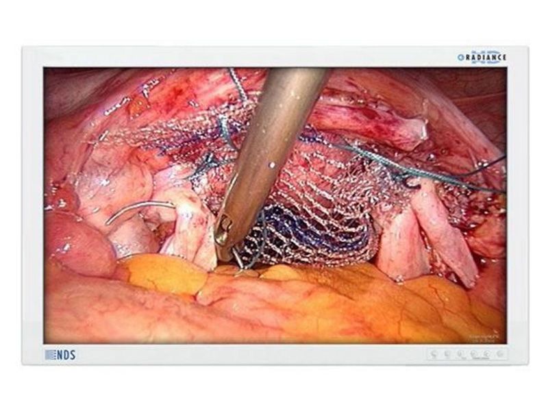NDSsi Radiance 32" FHD G2 Surgical LCD Monitor with Single Fiber 90R0077