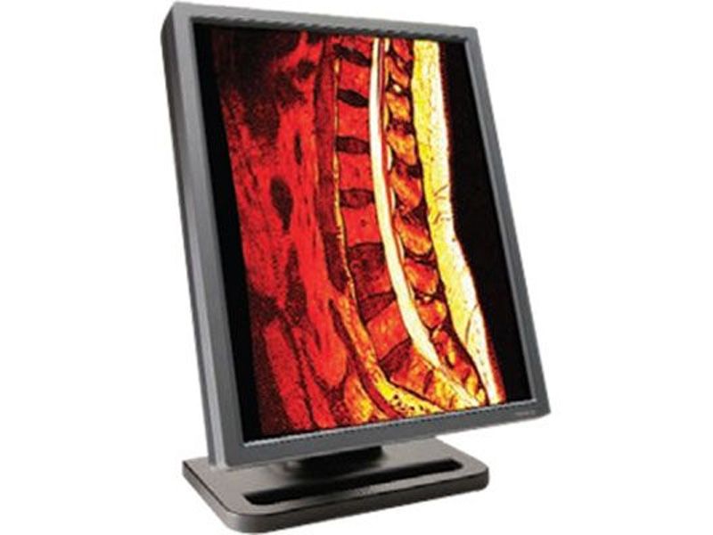 NDSsi DOME E2CHB 2MP Diagnostic Radiology Monitor