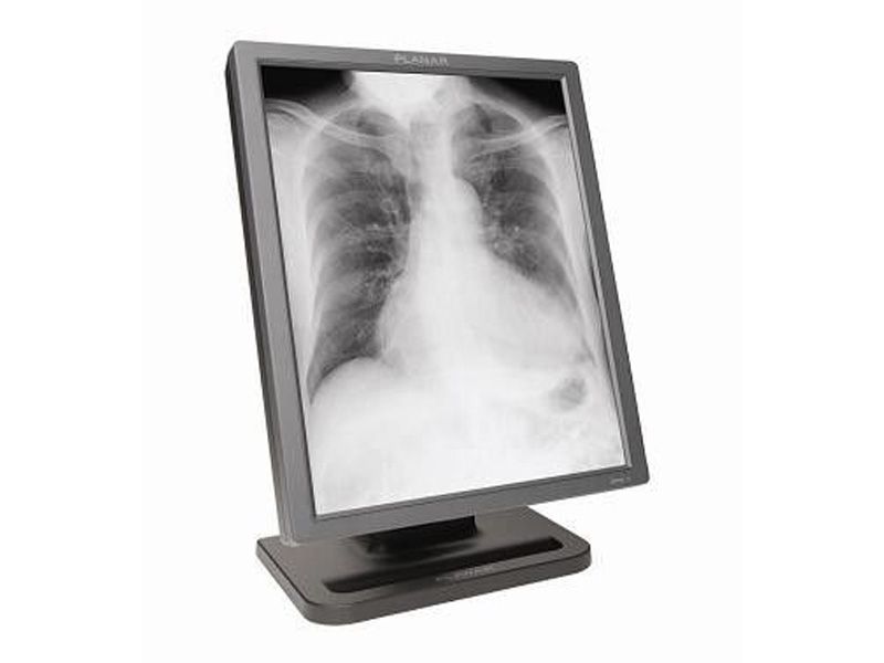NDSsi Dome E3 3MP Diagnostic Radiology Monitor