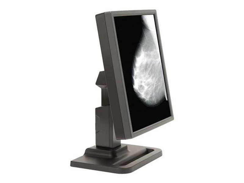 NDSsi Dome E5 5MP Diagnostic Radiology Monitor