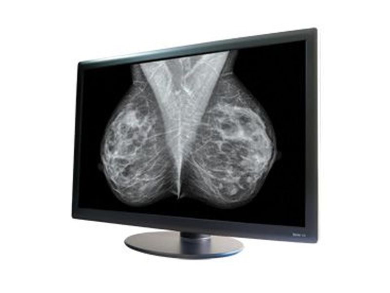 NDSsi Dome S10 10MP Diagnostic Radiology Monitor