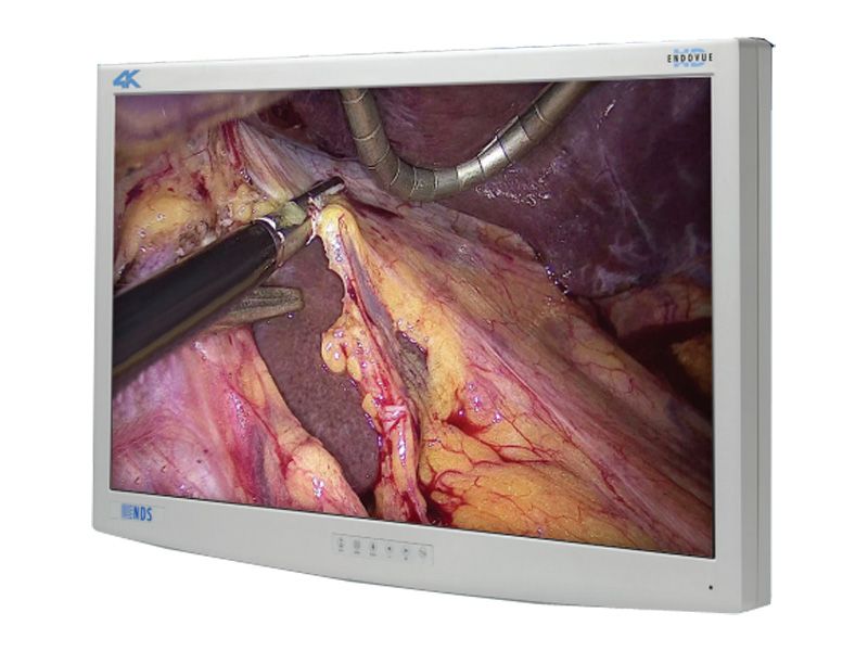 NDSsi EndoVue Plus 4K UHD 32" Surgical LCD Monitor
