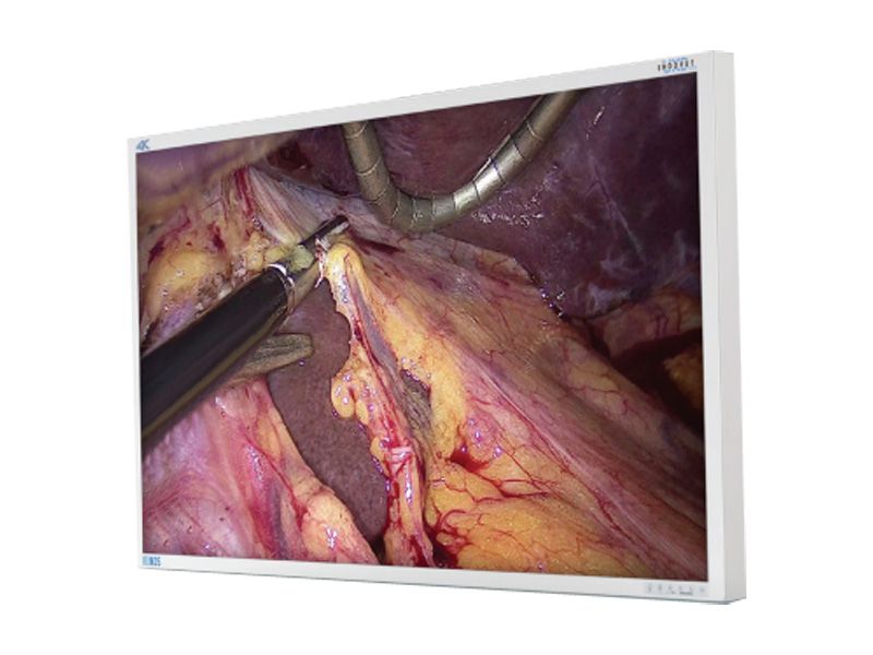 NDSsi EndoVue Plus 55" 4K UHD Surgical LCD Monitor