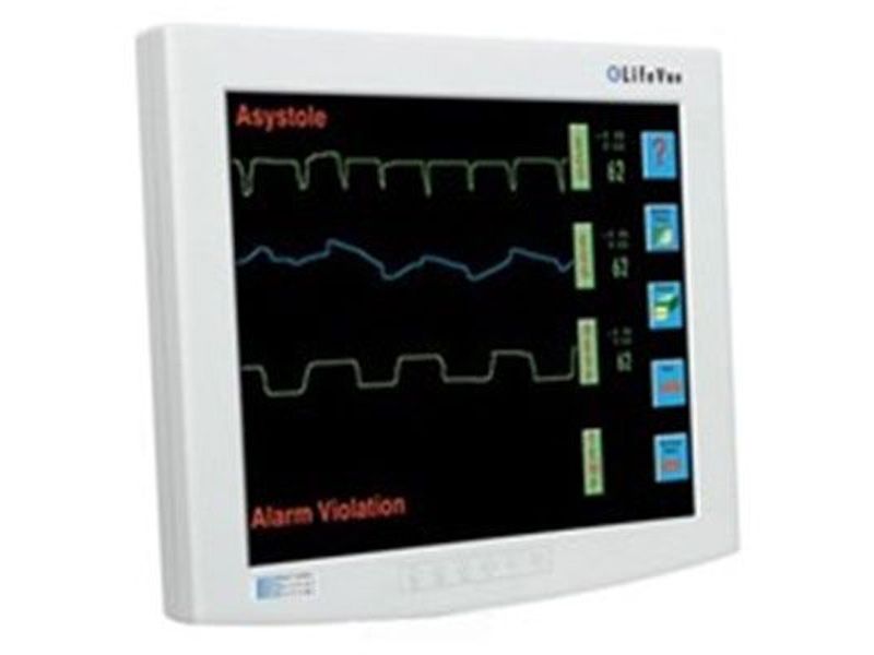 NDS LifeVue 15 inch Monitoring Display 90M0329