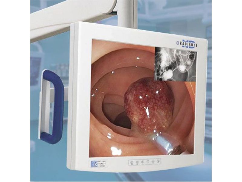 NDSsi Radiance 19" SXGA Surgical LCD Monitor