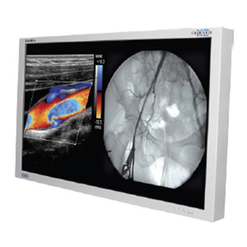 NDSsi Radiance 55" G2 FHD LED Surgical Monitor - 90R0068