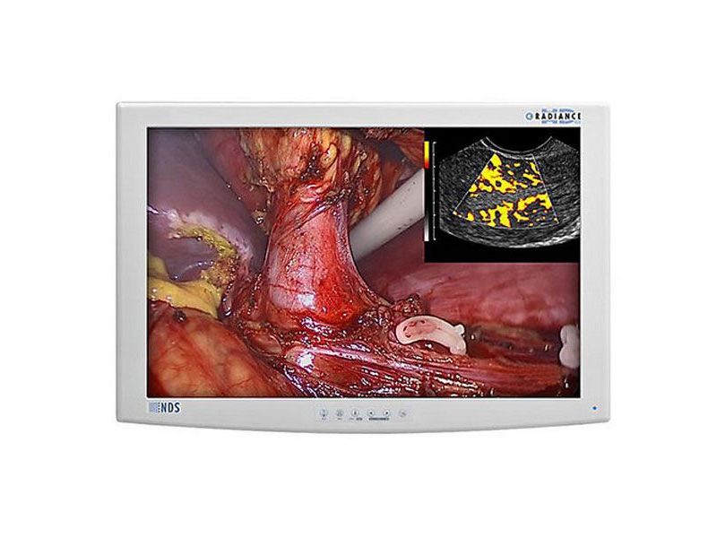 NDSsi Radiance 24" G2 WUXGA Surgical LCD Monitor