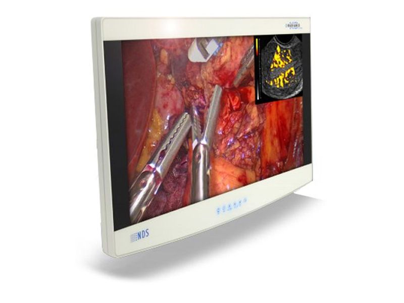 NDSsi Radiance Ultra 27" FHD Endoscopy Surgical LCD Monitor