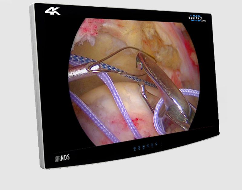 NDSsi Radiance Ultra 4K UHD 32" Surgical LCD Monitor