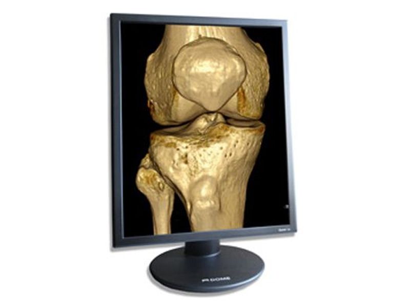 NDSsi DOME S3c-1 3MP Diagnostic Radiology Monitor