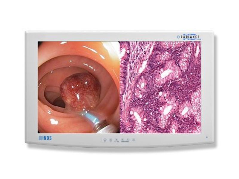 NDSsi SC-WU23-A1511 23" LCD Monitor