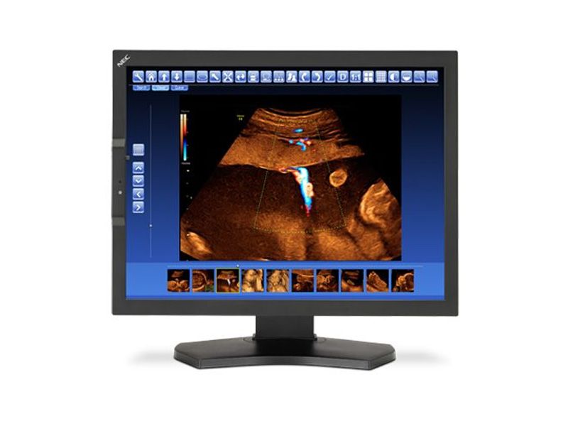 NEC MD210C2 2MP Diagnostic Radiology Monitor