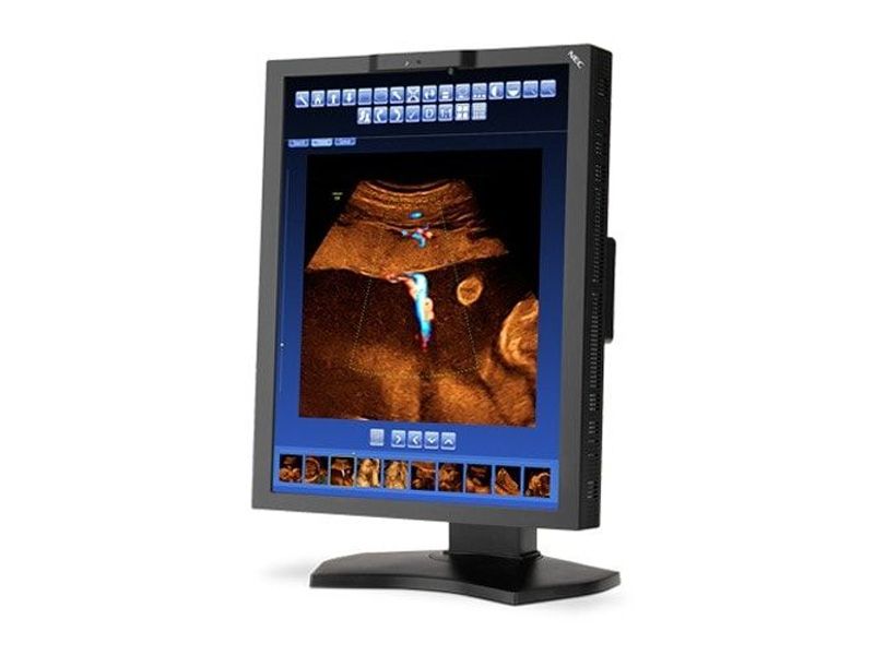 NEC MD210C2 2MP Diagnostic Radiology Monitor