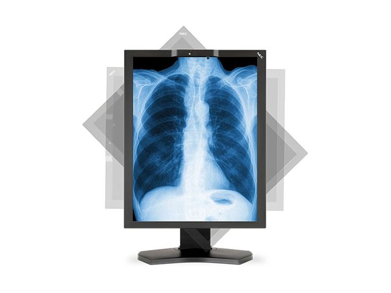 NEC MD210C3 3MP Diagnostic Radiology Monitor