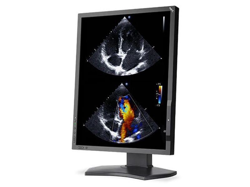 NEC MDC212C2 2MP Clinical Review Display Monitor