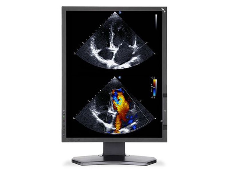 NEC MDC212C2 2MP Clinical Review Display Monitor