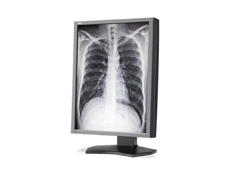 NEC MD212G3 3MP Diagnostic Radiology Monitor