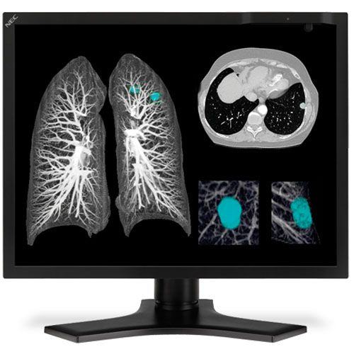 NEC MD212MC 2MP Color Diagnostic Monitor