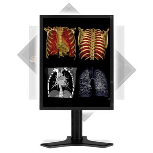 NEC MD212MC 2MP Color Diagnostic Monitor